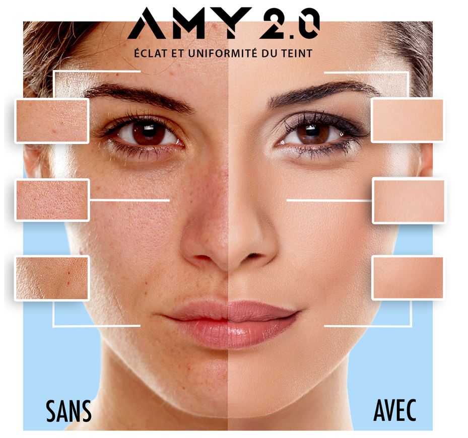amy 2.0_technologie ipl_éclat du teint_machine amy 2.0